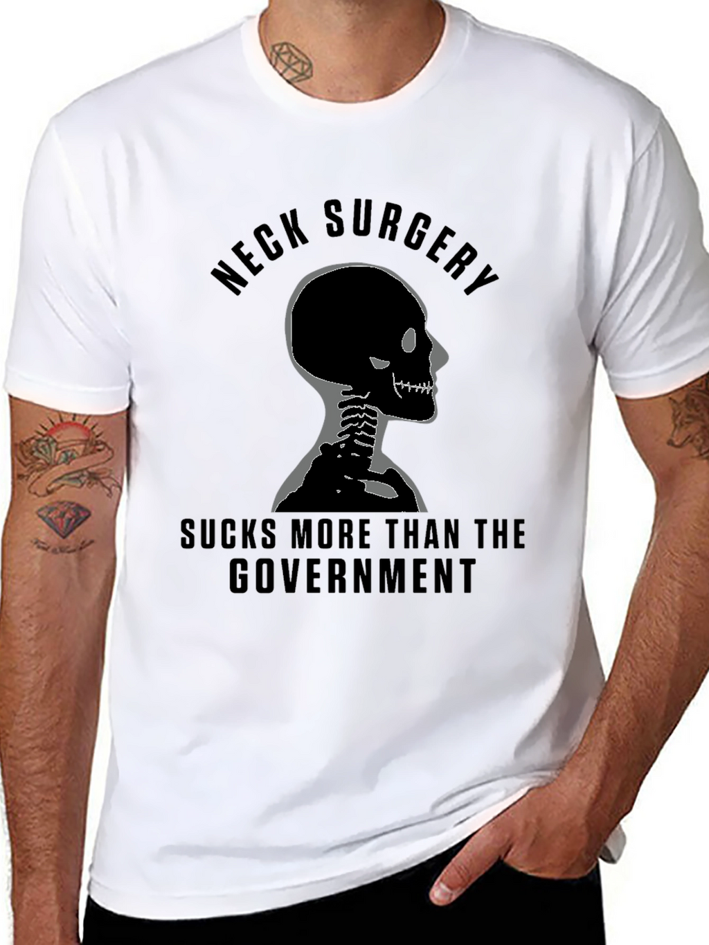 Neck Surgery Skeleton Graphic Tee