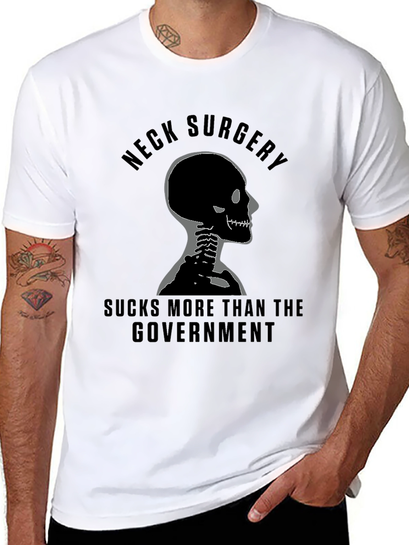 Neck Surgery Skeleton Graphic Tee