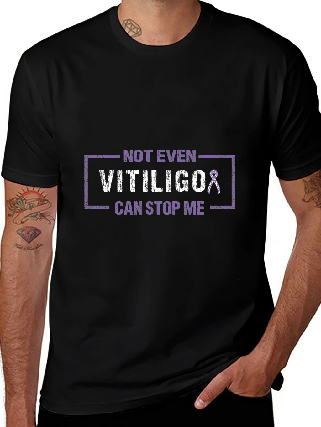 Vitiligo Awareness T-Shirt