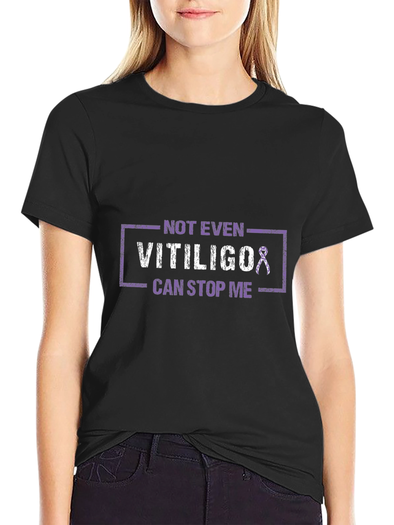 Vitiligo Awareness T-Shirt