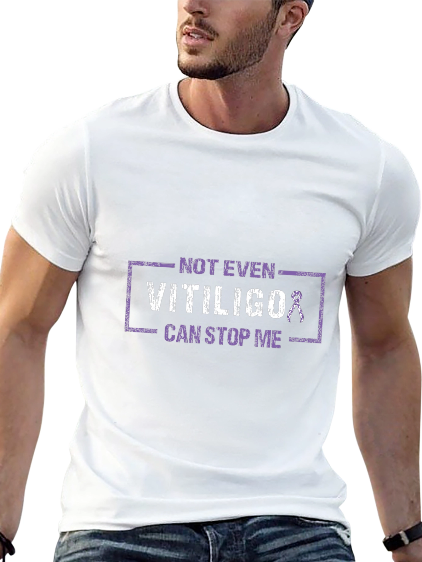 Vitiligo Awareness T-Shirt