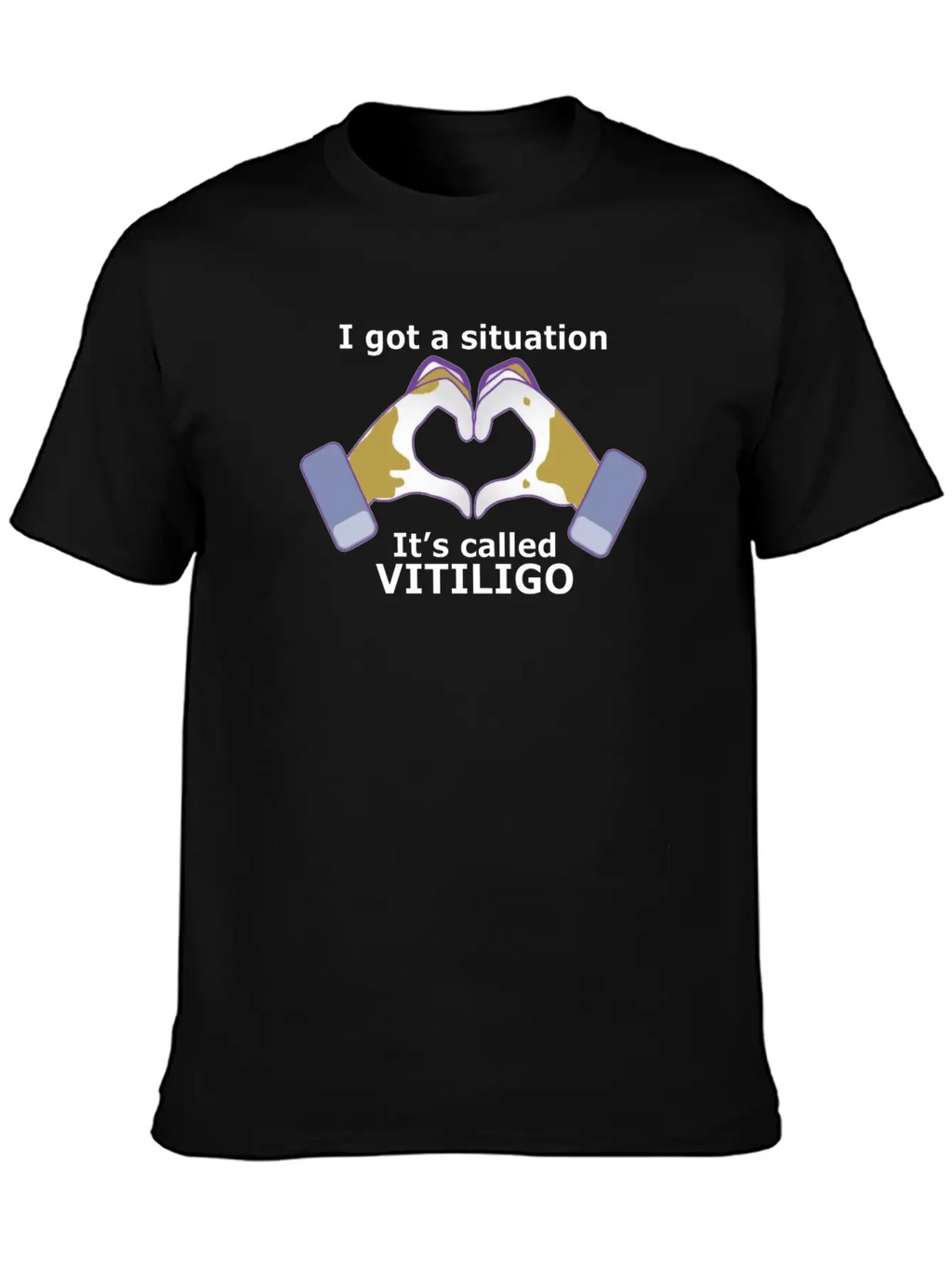 I Got A Situation, It's Called VITILIGO Stylish Everyday T-Shirt – Unisex Basic Cotton Tee