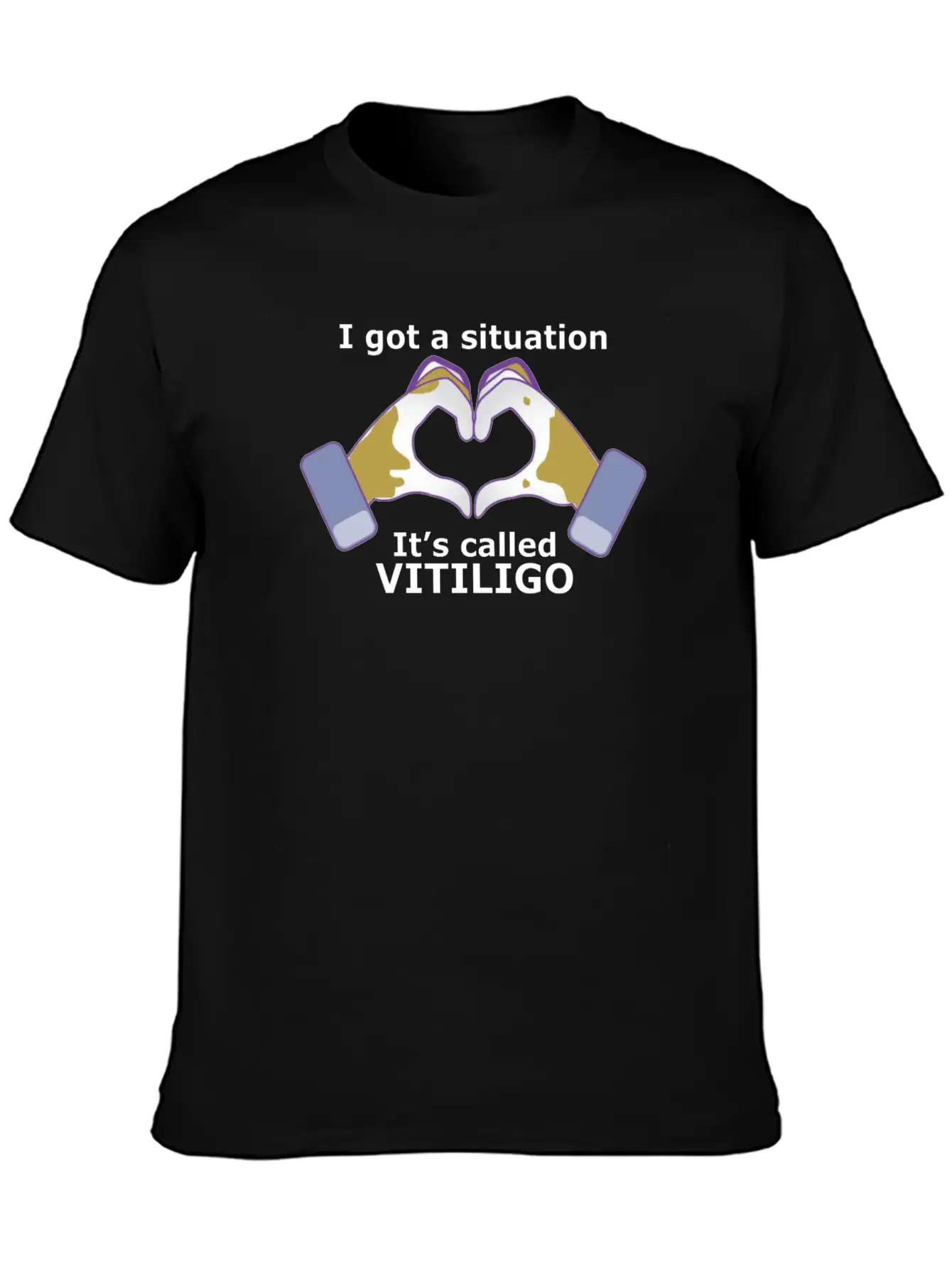 I Got A Situation, It's Called VITILIGO Stylish Everyday T-Shirt – Unisex Basic Cotton Tee