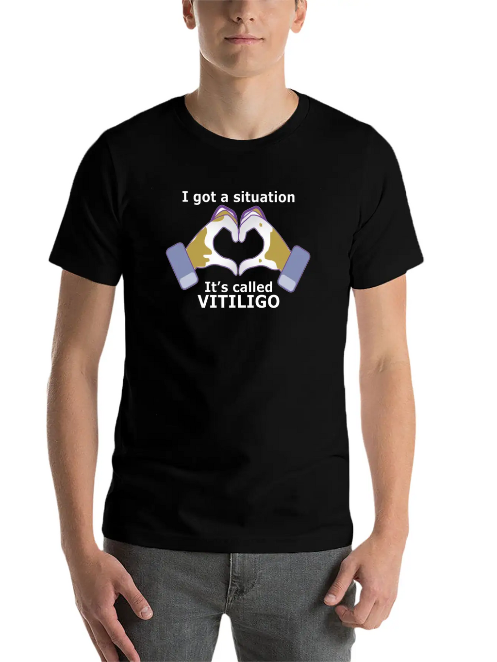 I Got A Situation, It's Called VITILIGO Stylish Everyday T-Shirt – Unisex Basic Cotton Tee