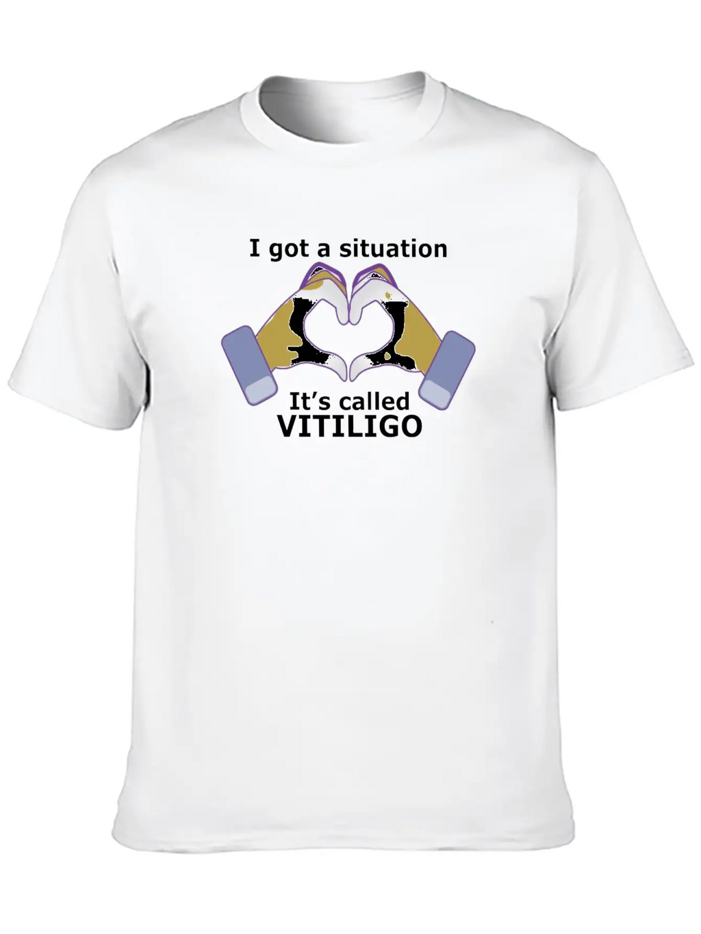 I Got A Situation, It's Called VITILIGO Stylish Everyday T-Shirt – Unisex Basic Cotton Tee