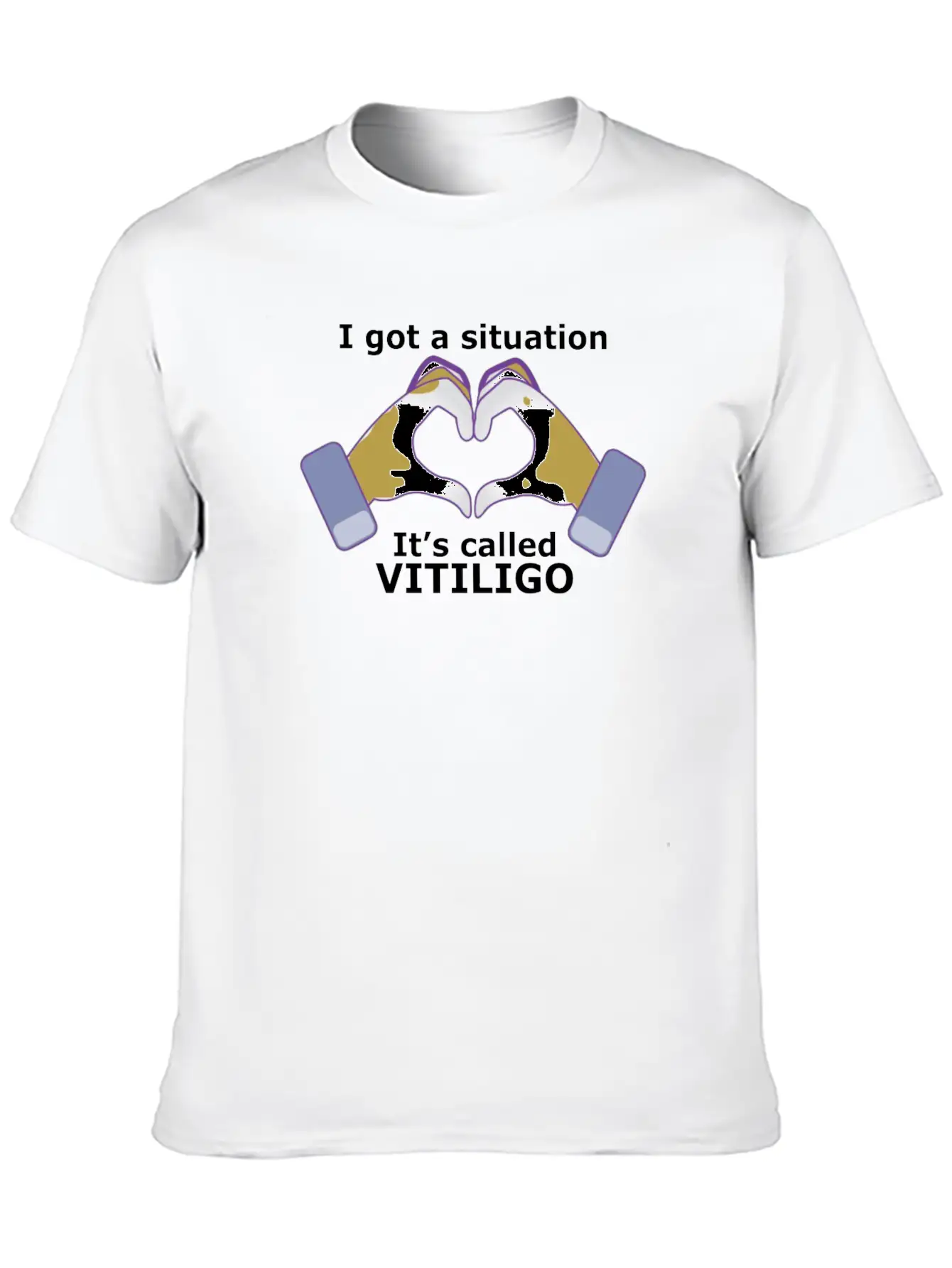 I Got A Situation, It's Called VITILIGO Stylish Everyday T-Shirt – Unisex Basic Cotton Tee