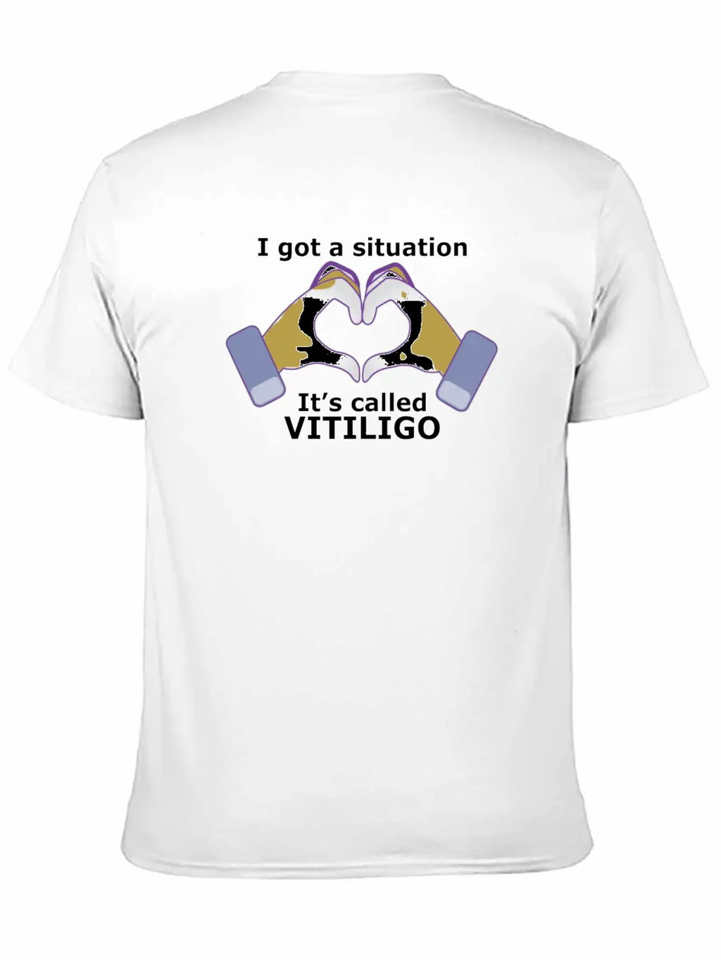 I Got A Situation, It's Called VITILIGO Stylish Everyday T-Shirt – Unisex Basic Cotton Tee