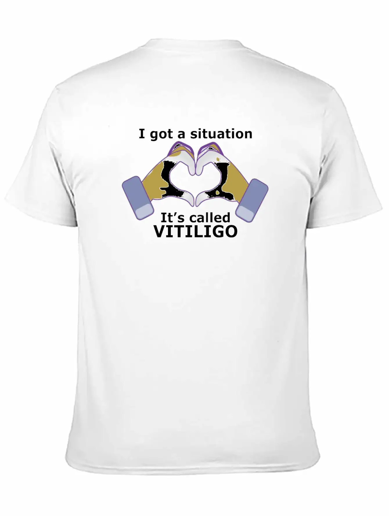 I Got A Situation, It's Called VITILIGO Stylish Everyday T-Shirt – Unisex Basic Cotton Tee