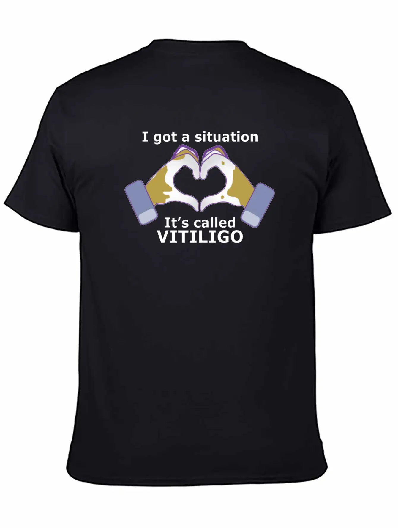 I Got A Situation, It's Called VITILIGO Stylish Everyday T-Shirt – Unisex Basic Cotton Tee