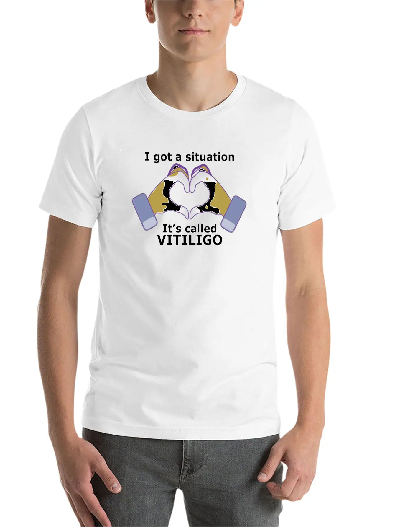 I Got A Situation, It's Called VITILIGO Stylish Everyday T-Shirt – Unisex Basic Cotton Tee