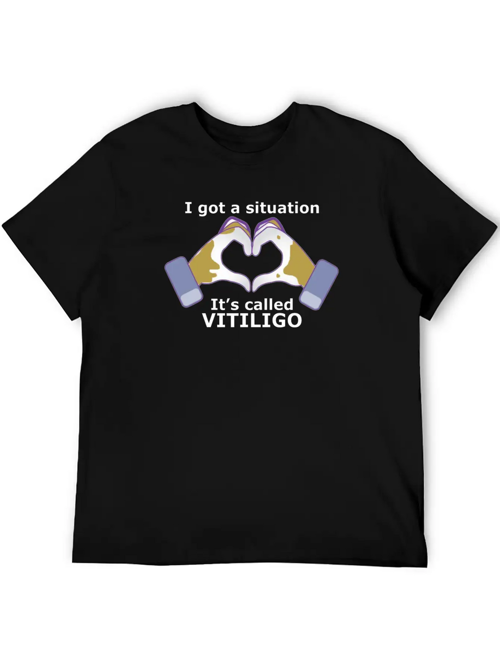 I Got A Situation, It's Called VITILIGO Stylish Everyday T-Shirt – Unisex Basic Cotton Tee