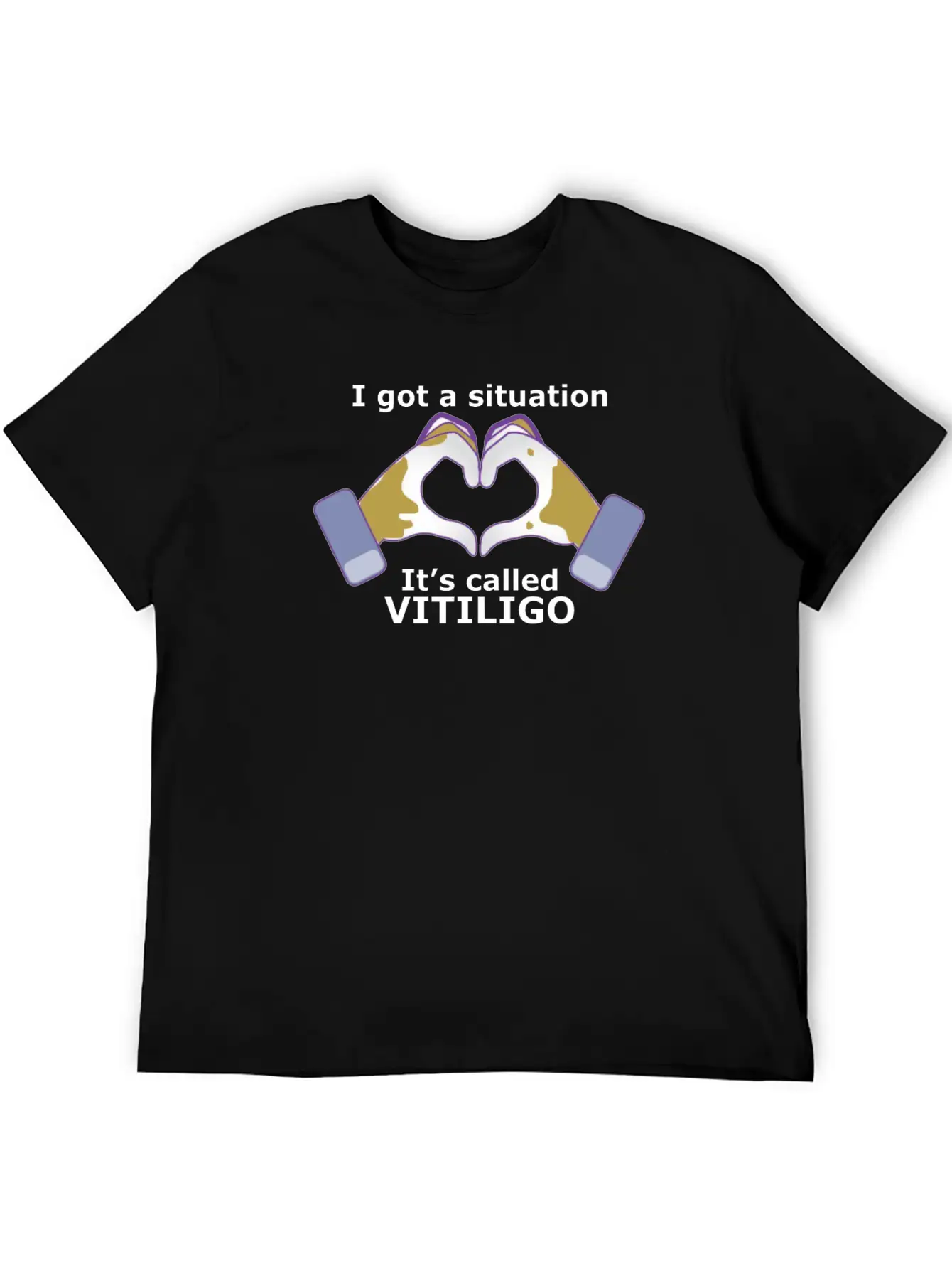 I Got A Situation, It's Called VITILIGO Stylish Everyday T-Shirt – Unisex Basic Cotton Tee