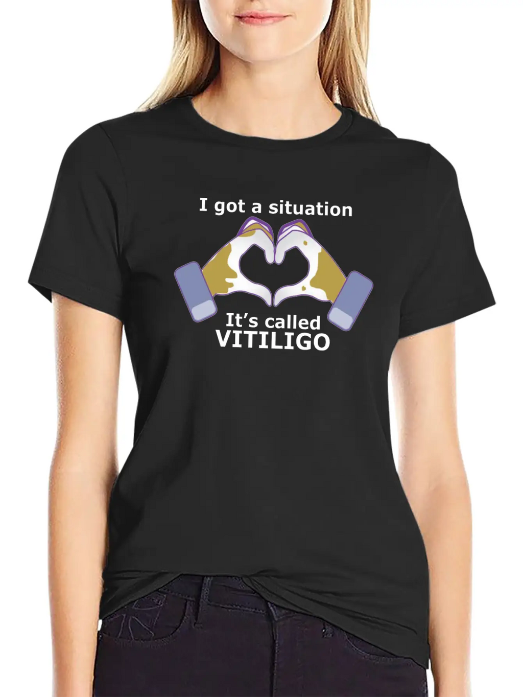 I Got A Situation, It's Called VITILIGO Stylish Everyday T-Shirt – Unisex Basic Cotton Tee