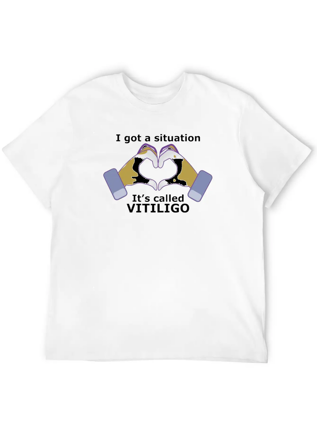 I Got A Situation, It's Called VITILIGO Stylish Everyday T-Shirt – Unisex Basic Cotton Tee