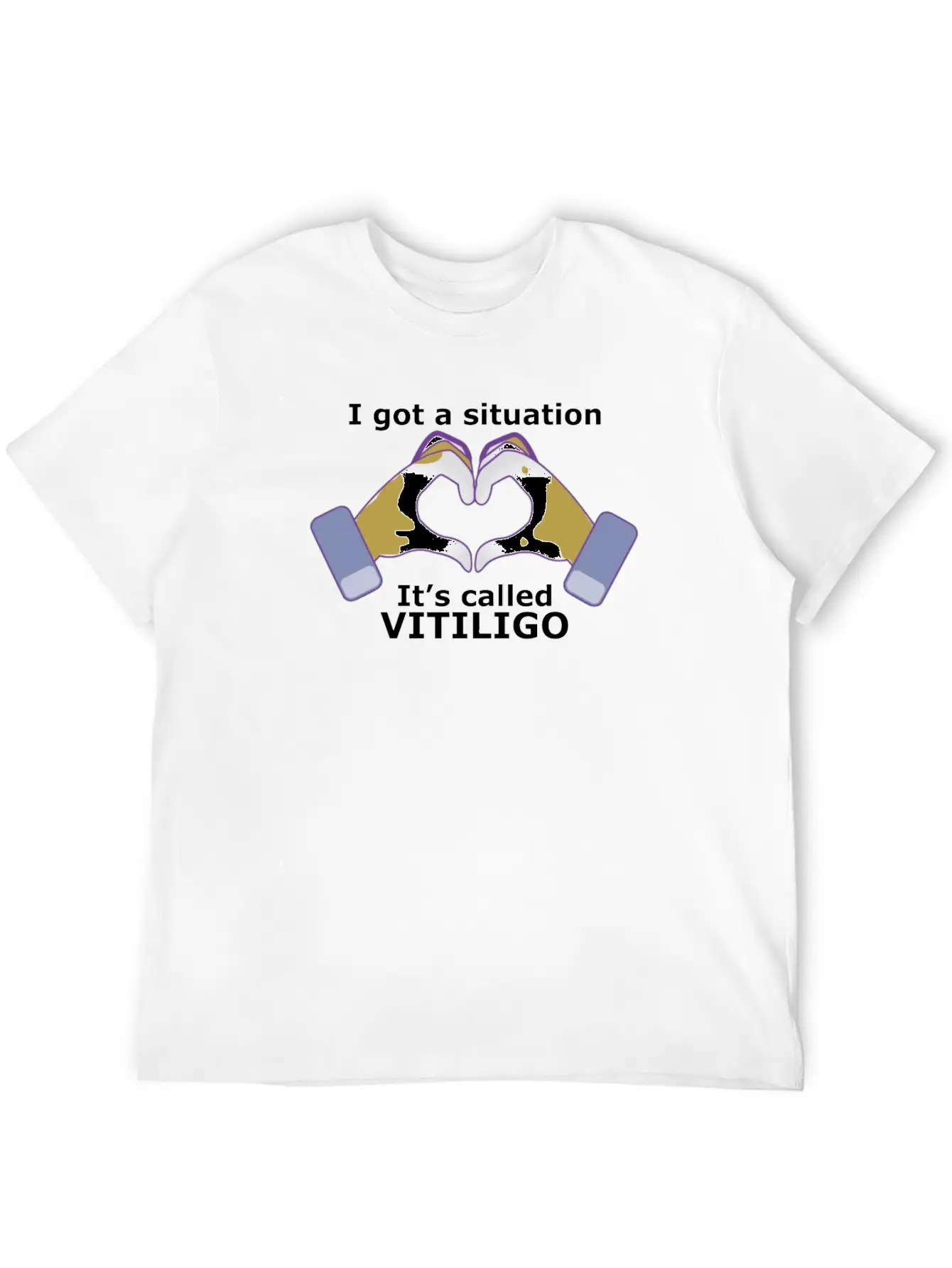 I Got A Situation, It's Called VITILIGO Stylish Everyday T-Shirt – Unisex Basic Cotton Tee