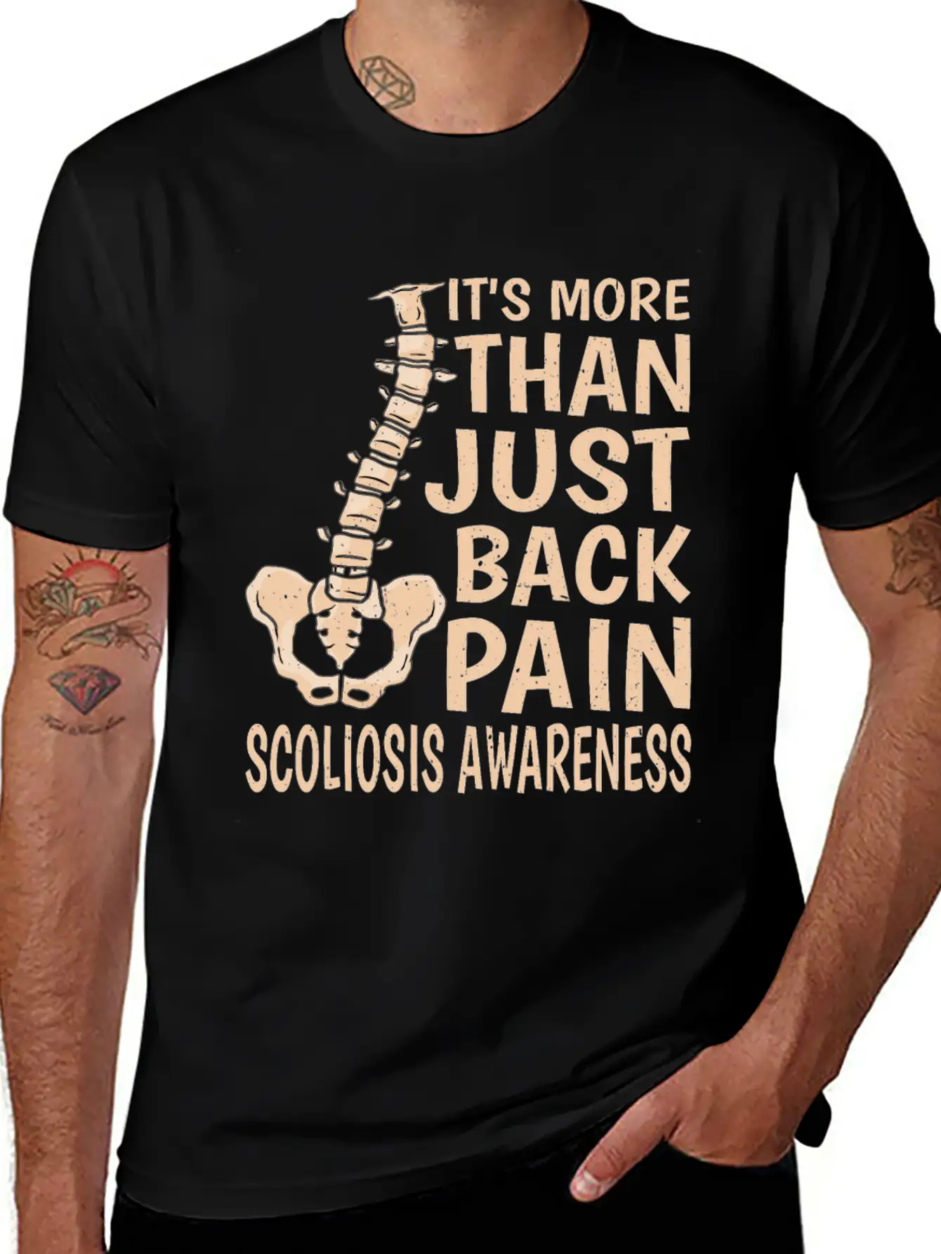 It's More Than Just Back Pain, Scoliosis 5 Unisex Casual T-Shirt – Clean Design For Daily Comfort